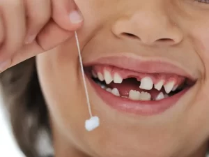 دلیل دیر افتادن دندان شیری