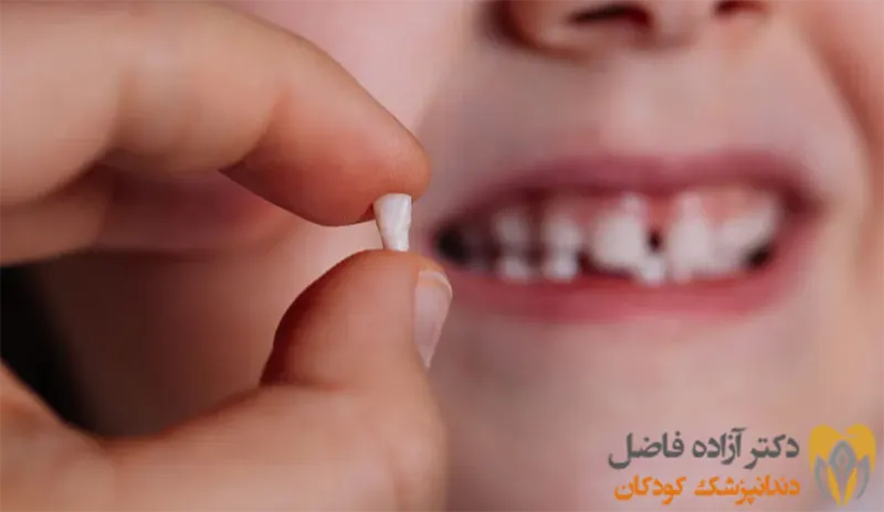 زمان افتادن دندان شیری