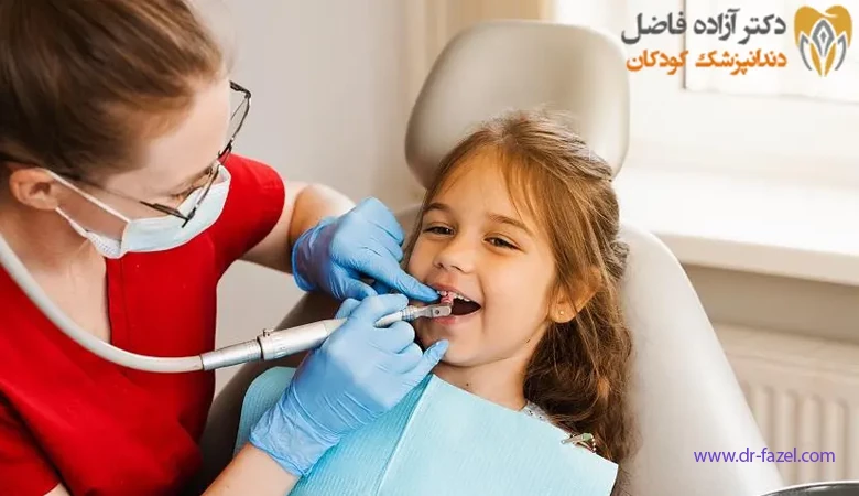 اهمیت جرم گیری دندان کودکان